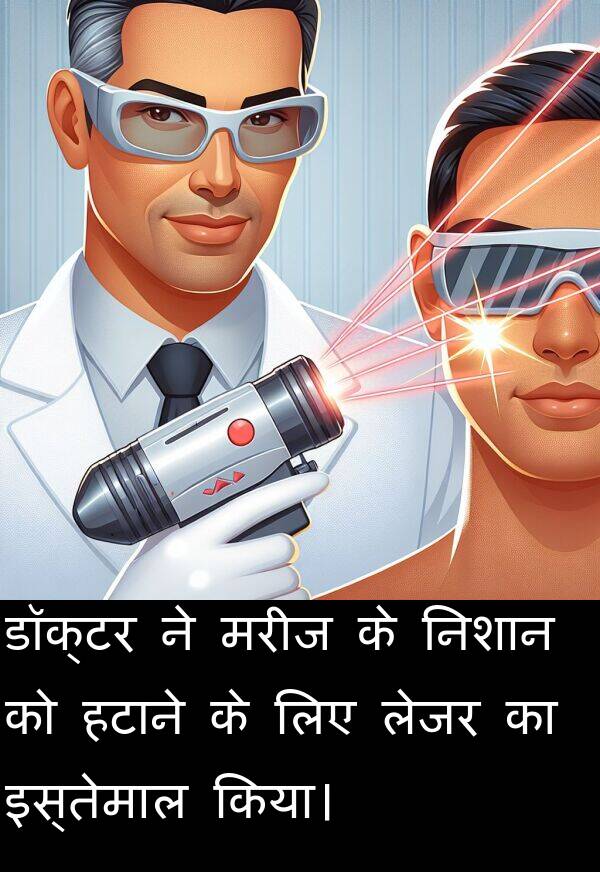 लेजर: डॉक्टर ने मरीज के निशान को हटाने के लिए लेजर का इस्तेमाल किया।