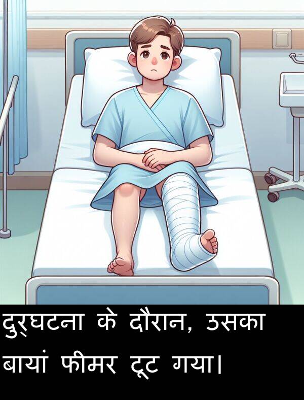 उसका: दुर्घटना के दौरान, उसका बायां फीमर टूट गया।