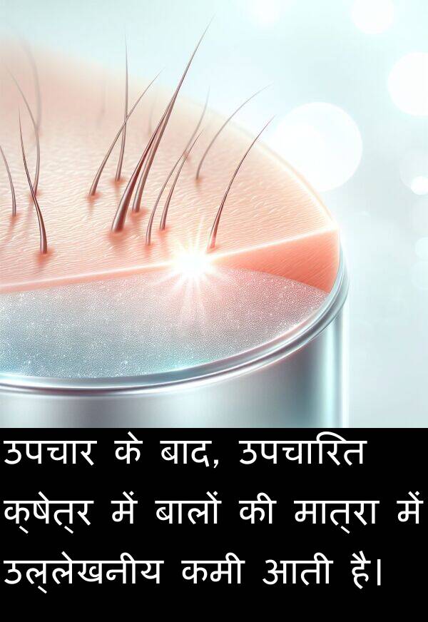 उपचार: उपचार के बाद, उपचारित क्षेत्र में बालों की मात्रा में उल्लेखनीय कमी आती है।