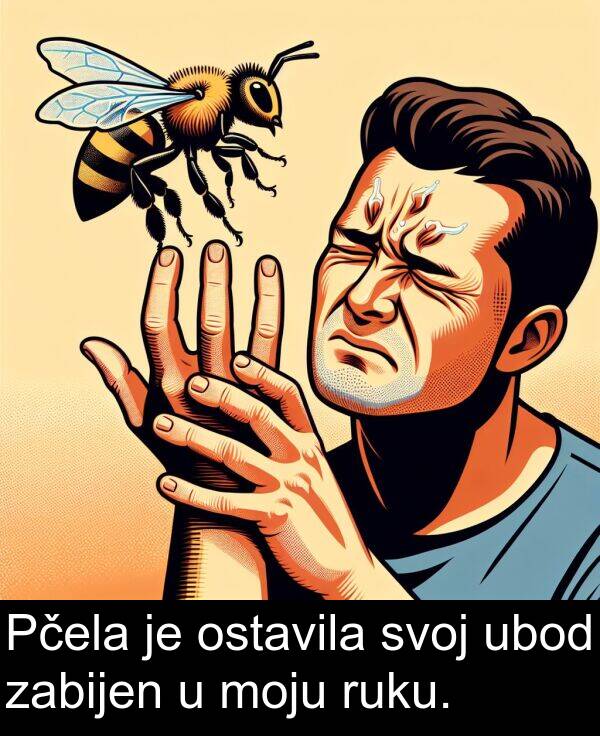 ostavila: Pčela je ostavila svoj ubod zabijen u moju ruku.