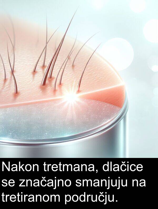 dlačice: Nakon tretmana, dlačice se značajno smanjuju na tretiranom području.
