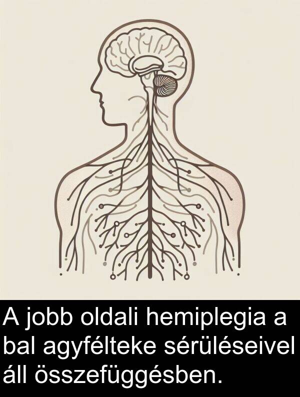 oldali: A jobb oldali hemiplegia a bal agyfélteke sérüléseivel áll összefüggésben.