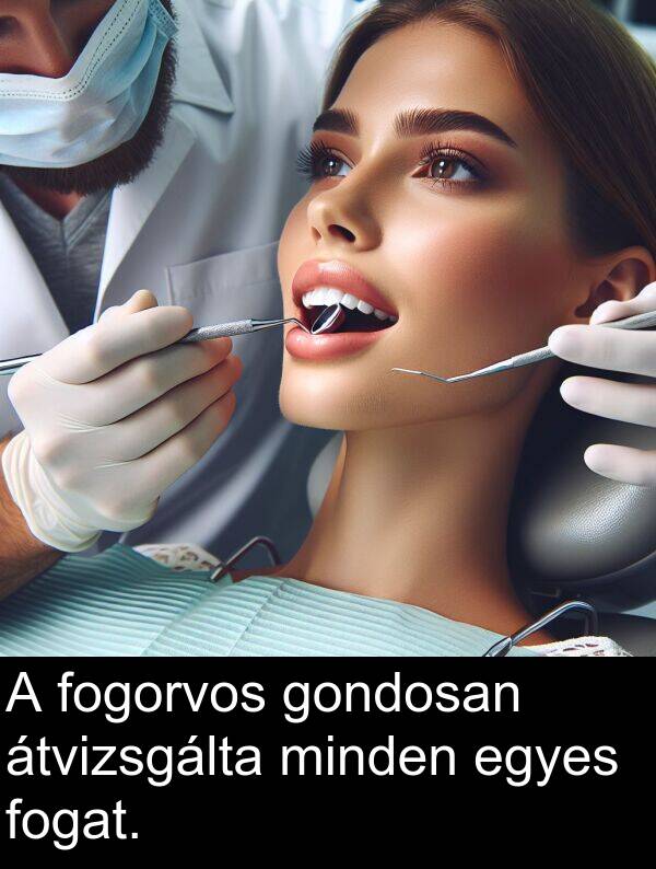 minden: A fogorvos gondosan átvizsgálta minden egyes fogat.