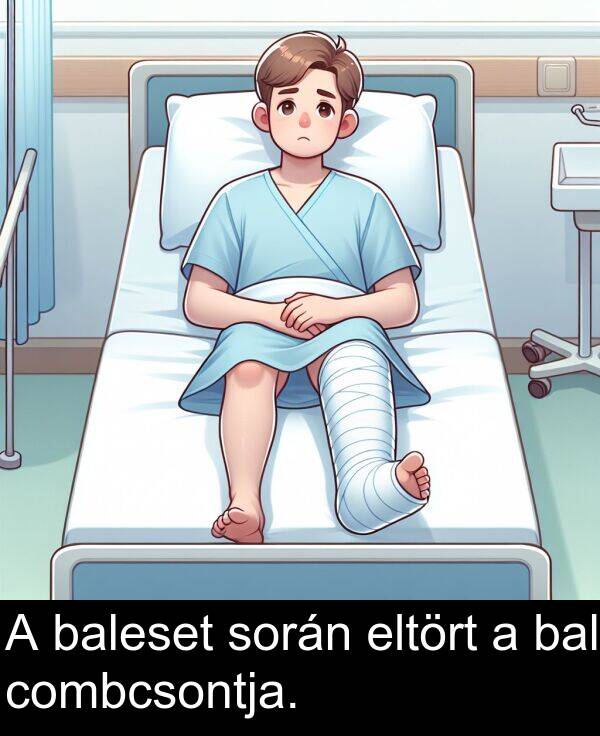 bal: A baleset során eltört a bal combcsontja.