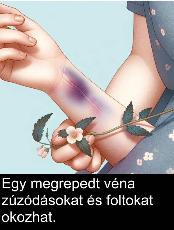okozhat: Egy megrepedt véna zúzódásokat és foltokat okozhat.