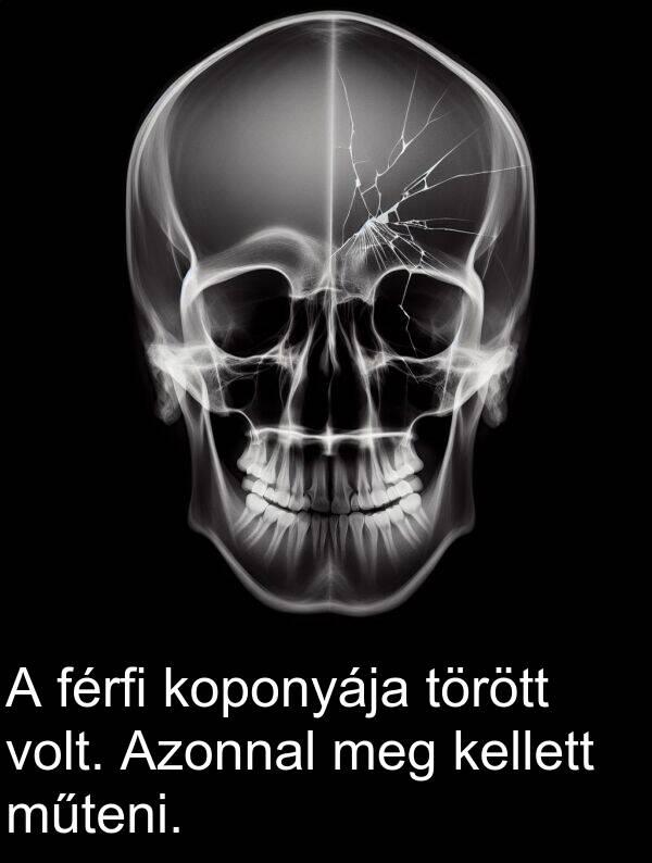 műteni: A férfi koponyája törött volt. Azonnal meg kellett műteni.