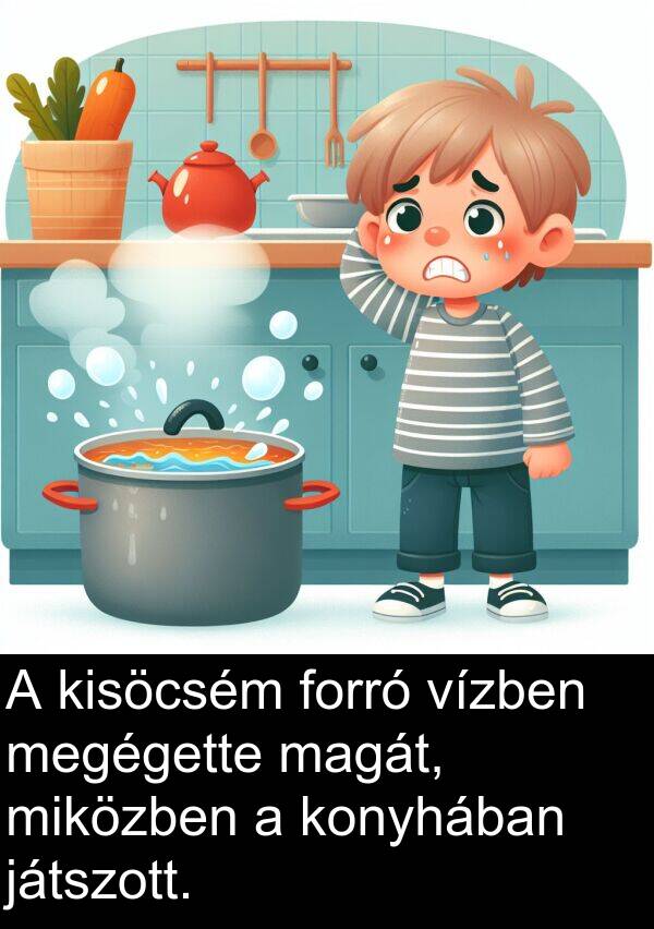 magát: A kisöcsém forró vízben megégette magát, miközben a konyhában játszott.