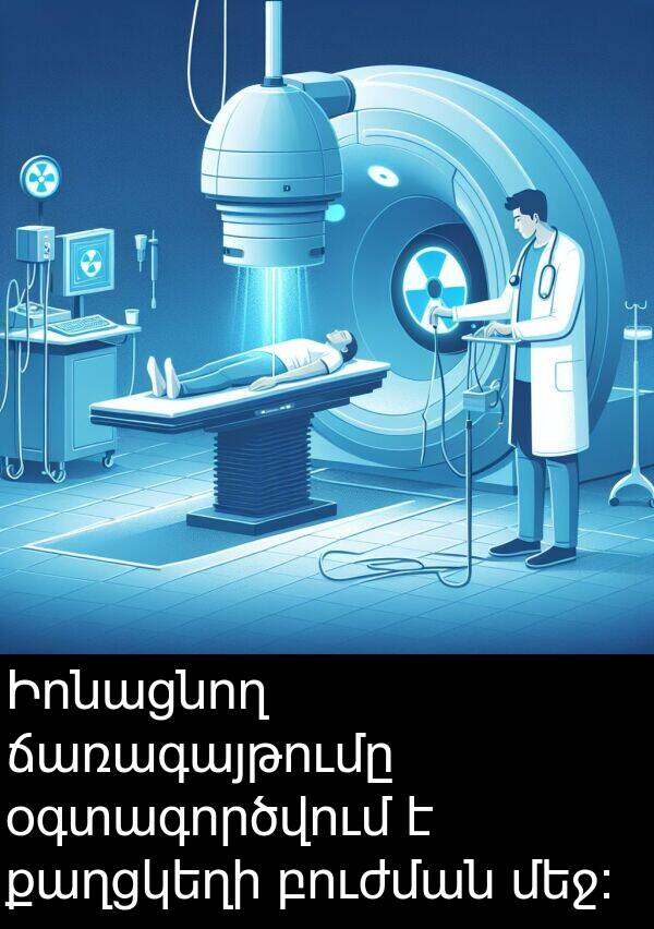 բուժման: Իոնացնող ճառագայթումը օգտագործվում է քաղցկեղի բուժման մեջ: