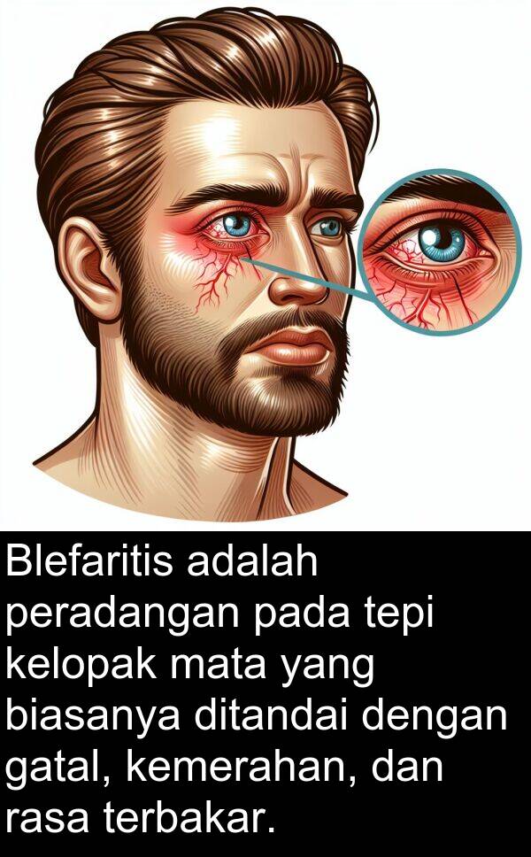 mata: Blefaritis adalah peradangan pada tepi kelopak mata yang biasanya ditandai dengan gatal, kemerahan, dan rasa terbakar.