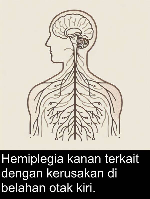 otak: Hemiplegia kanan terkait dengan kerusakan di belahan otak kiri.