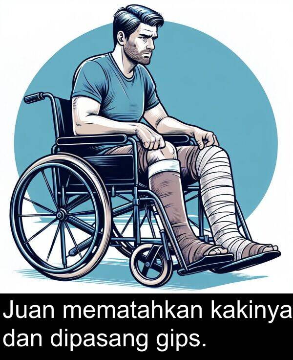 mematahkan: Juan mematahkan kakinya dan dipasang gips.