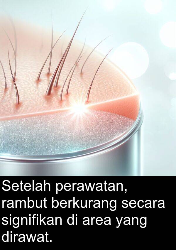 secara: Setelah perawatan, rambut berkurang secara signifikan di area yang dirawat.