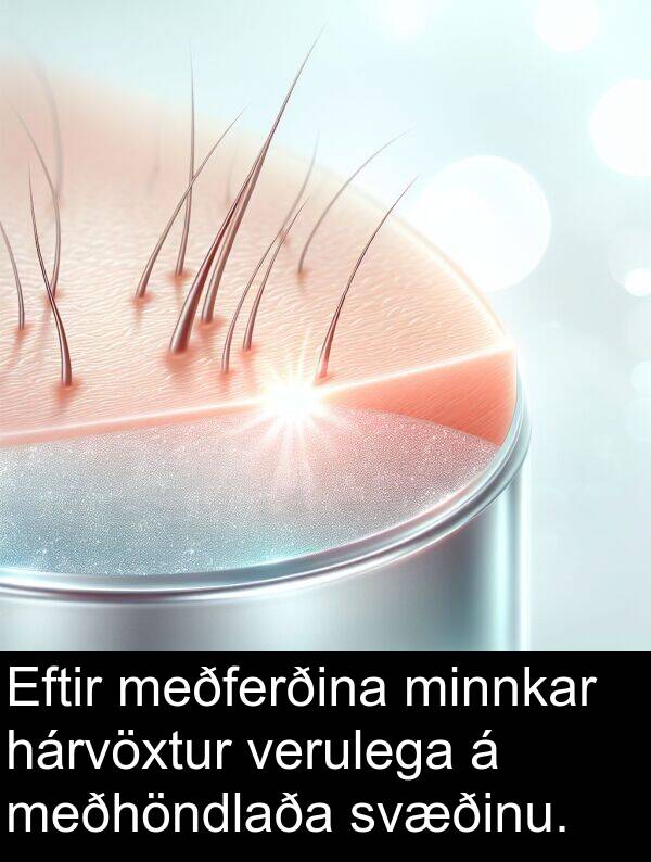hárvöxtur: Eftir meðferðina minnkar hárvöxtur verulega á meðhöndlaða svæðinu.