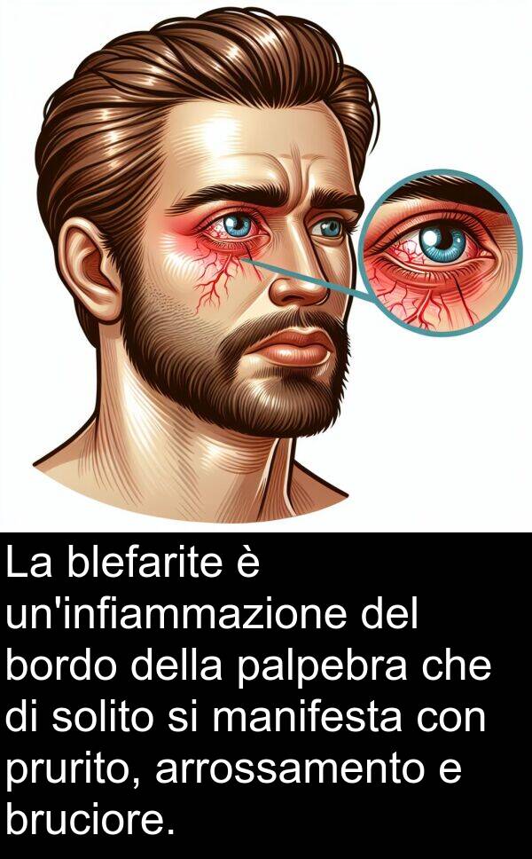 palpebra: La blefarite è un'infiammazione del bordo della palpebra che di solito si manifesta con prurito, arrossamento e bruciore.