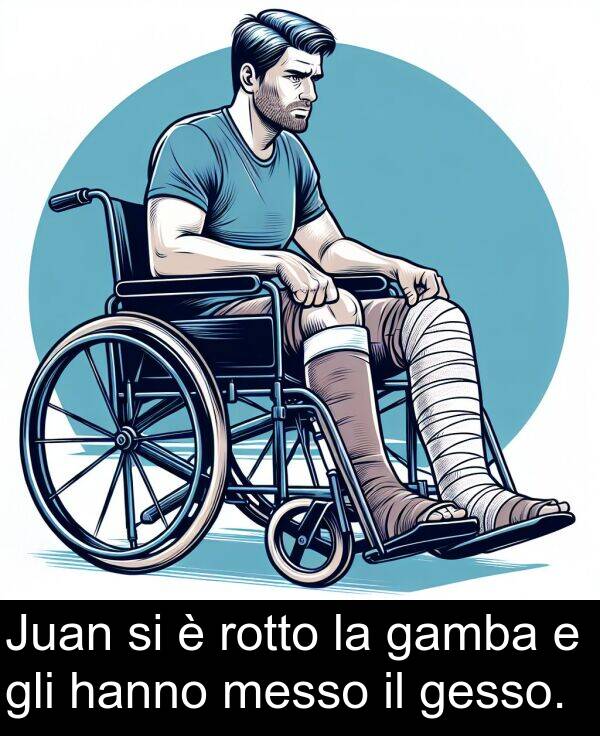rotto: Juan si è rotto la gamba e gli hanno messo il gesso.