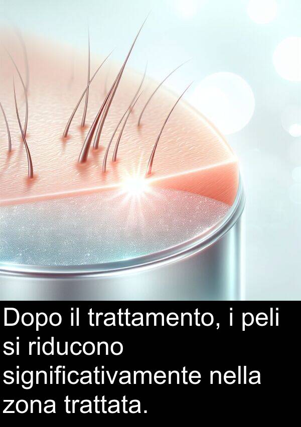 trattata: Dopo il trattamento, i peli si riducono significativamente nella zona trattata.
