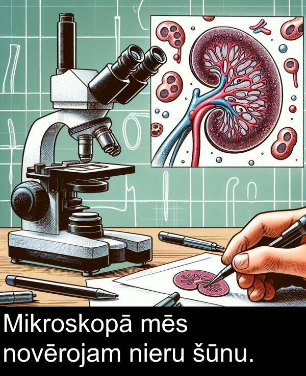 šūnu: Mikroskopā mēs novērojam nieru šūnu.