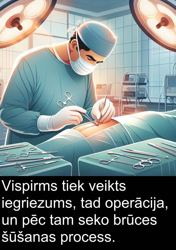 operācija: Vispirms tiek veikts iegriezums, tad operācija, un pēc tam seko brūces šūšanas process.