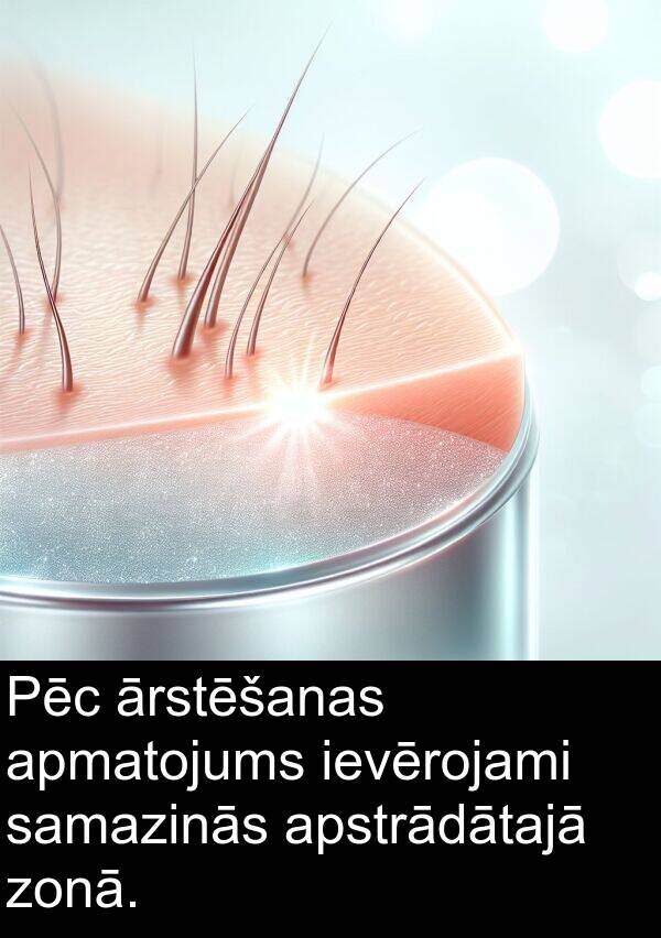 apstrādātajā: Pēc ārstēšanas apmatojums ievērojami samazinās apstrādātajā zonā.