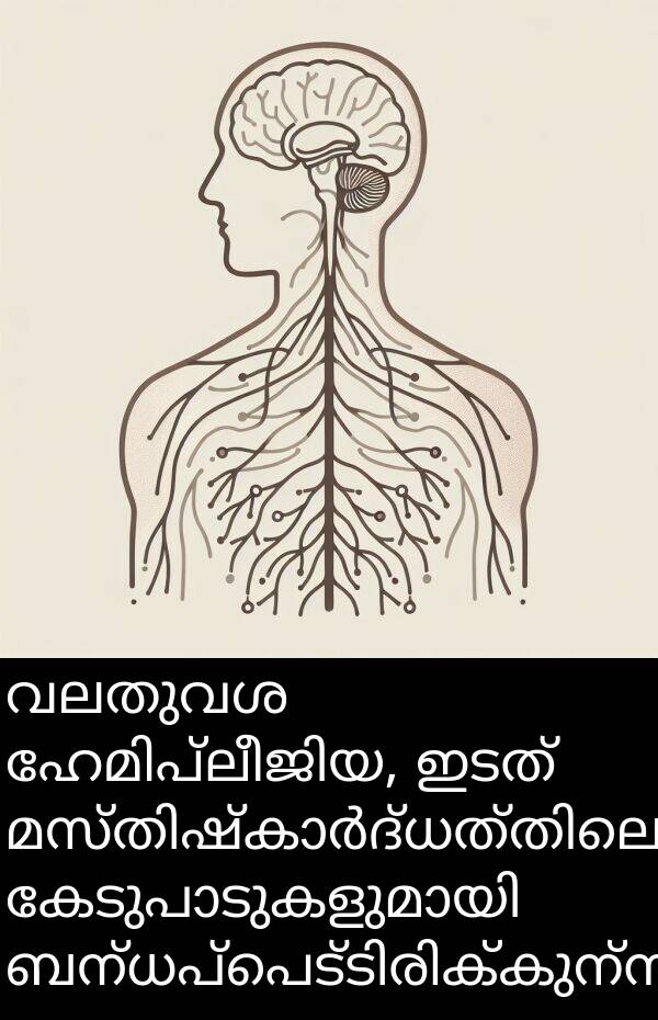 വലതുവശ: വലതുവശ ഹേമിപ്ലീജിയ, ഇടത് മസ്തിഷ്കാർദ്ധത്തിലെ കേടുപാടുകളുമായി ബന്ധപ്പെട്ടിരിക്കുന്നു.
