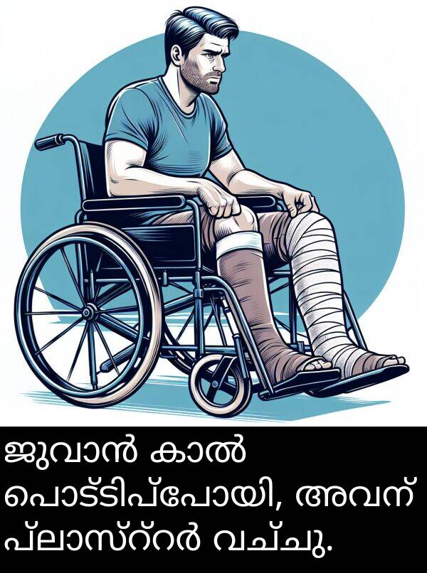 വച്ചു: ജുവാൻ കാൽ പൊട്ടിപ്പോയി, അവന്‍ പ്ലാസ്റ്റർ വച്ചു.