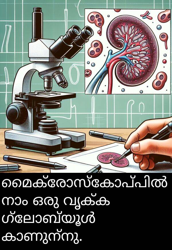 വൃക്ക: മൈക്രോസ്കോപ്പിൽ നാം ഒരു വൃക്ക ഗ്ലോബ്യൂൾ കാണുന്നു.