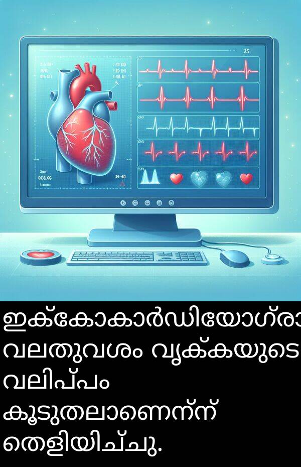 വൃക്കയുടെ: ഇക്കോകാർഡിയോഗ്രാം വലതുവശം വൃക്കയുടെ വലിപ്പം കൂടുതലാണെന്ന് തെളിയിച്ചു.