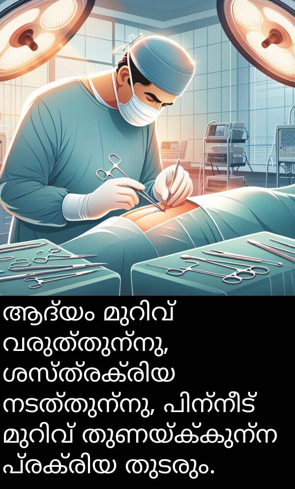 വരുത്തുന്നു: ആദ്യം മുറിവ് വരുത്തുന്നു, ശസ്ത്രക്രിയ നടത്തുന്നു, പിന്നീട് മുറിവ് തുണയ്ക്കുന്ന പ്രക്രിയ തുടരും.