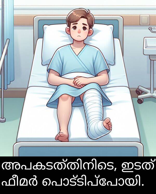 ഇടത്: അപകടത്തിനിടെ, ഇടത് ഫീമർ പൊട്ടിപ്പോയി.