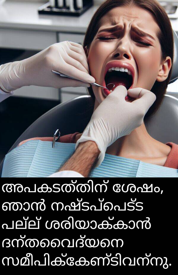 നഷ്ടപ്പെട്ട: അപകടത്തിന് ശേഷം, ഞാൻ നഷ്ടപ്പെട്ട പല്ല് ശരിയാക്കാൻ ദന്തവൈദ്യനെ സമീപിക്കേണ്ടിവന്നു.
