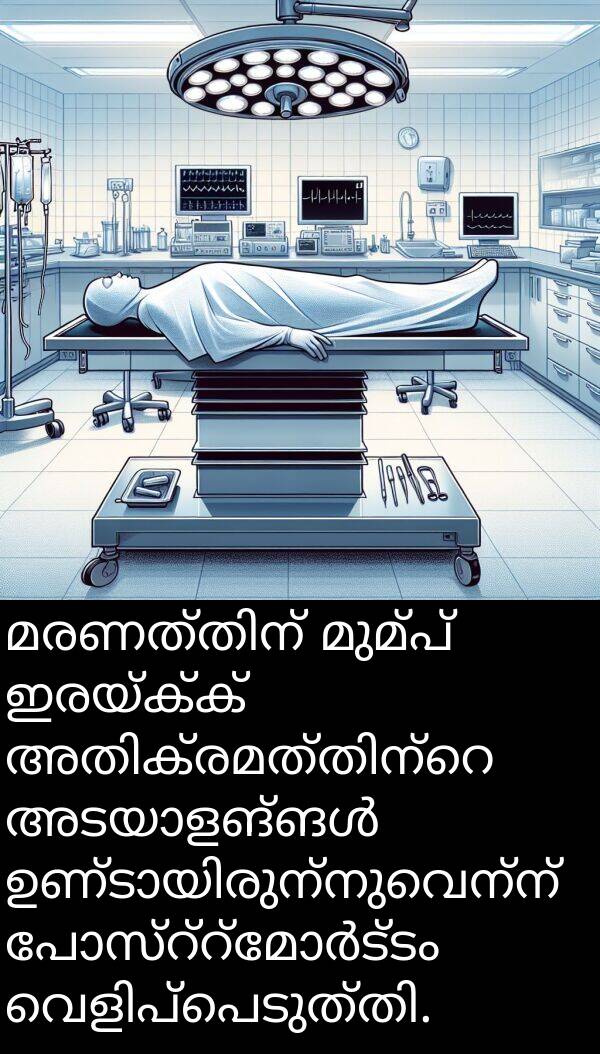 മുമ്പ്: മരണത്തിന് മുമ്പ് ഇരയ്ക്ക് അതിക്രമത്തിന്റെ അടയാളങ്ങൾ ഉണ്ടായിരുന്നുവെന്ന് പോസ്റ്റ്മോർട്ടം വെളിപ്പെടുത്തി.