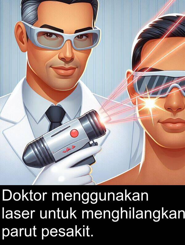 menghilangkan: Doktor menggunakan laser untuk menghilangkan parut pesakit.
