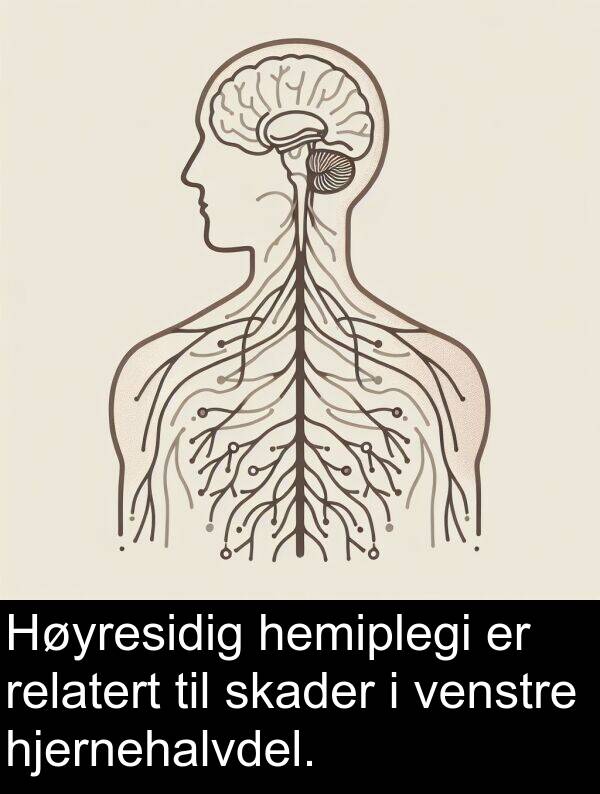 relatert: Høyresidig hemiplegi er relatert til skader i venstre hjernehalvdel.