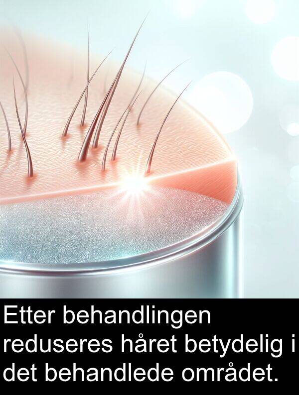 behandlede: Etter behandlingen reduseres håret betydelig i det behandlede området.