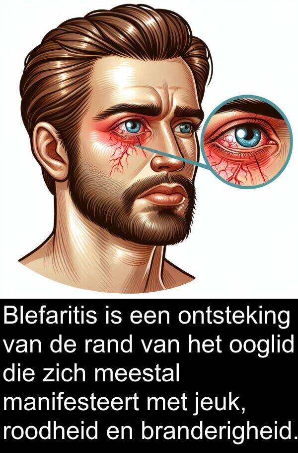 manifesteert: Blefaritis is een ontsteking van de rand van het ooglid die zich meestal manifesteert met jeuk, roodheid en branderigheid.