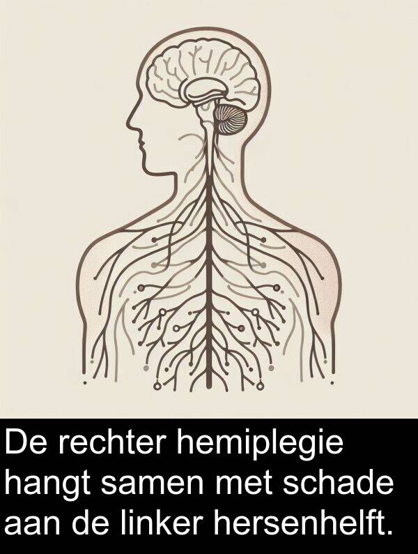 schade: De rechter hemiplegie hangt samen met schade aan de linker hersenhelft.