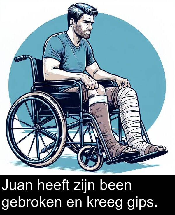 gips: Juan heeft zijn been gebroken en kreeg gips.
