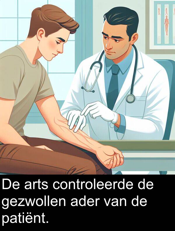 gezwollen: De arts controleerde de gezwollen ader van de patiënt.