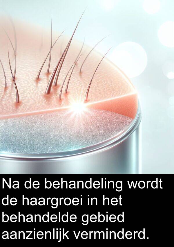 behandeling: Na de behandeling wordt de haargroei in het behandelde gebied aanzienlijk verminderd.