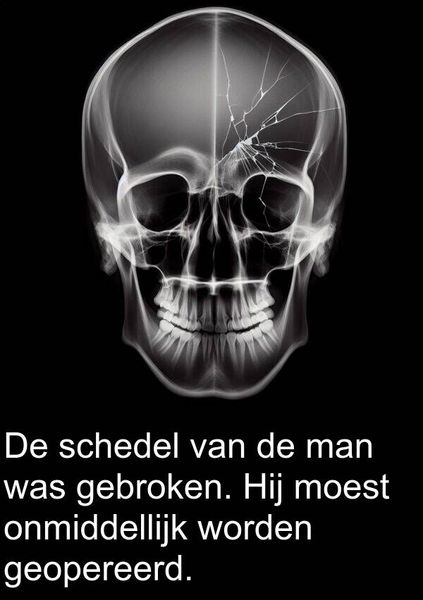 schedel: De schedel van de man was gebroken. Hij moest onmiddellijk worden geopereerd.