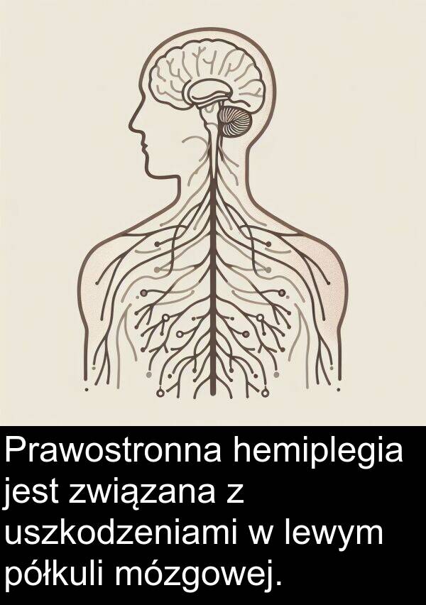 półkuli: Prawostronna hemiplegia jest związana z uszkodzeniami w lewym półkuli mózgowej.