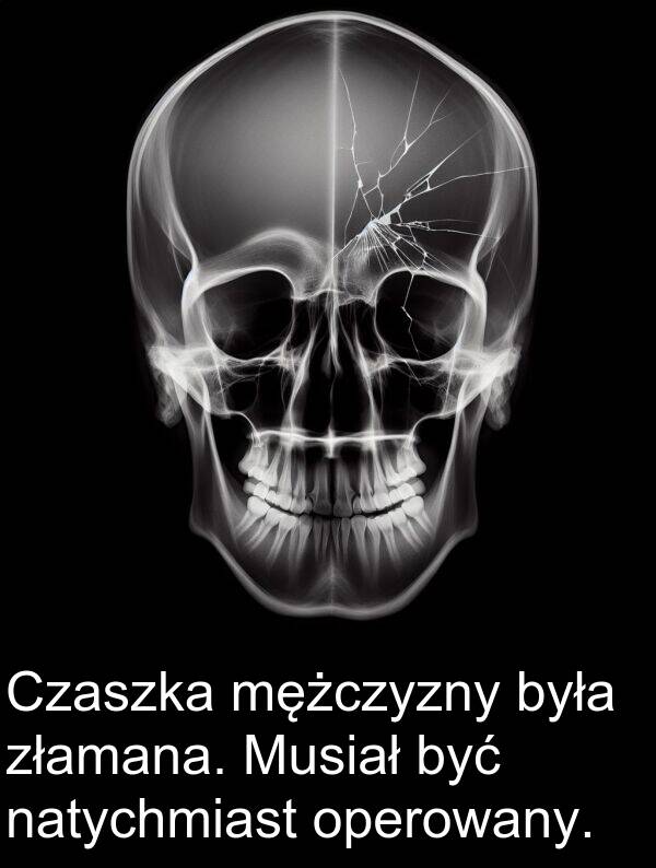 złamana: Czaszka mężczyzny była złamana. Musiał być natychmiast operowany.