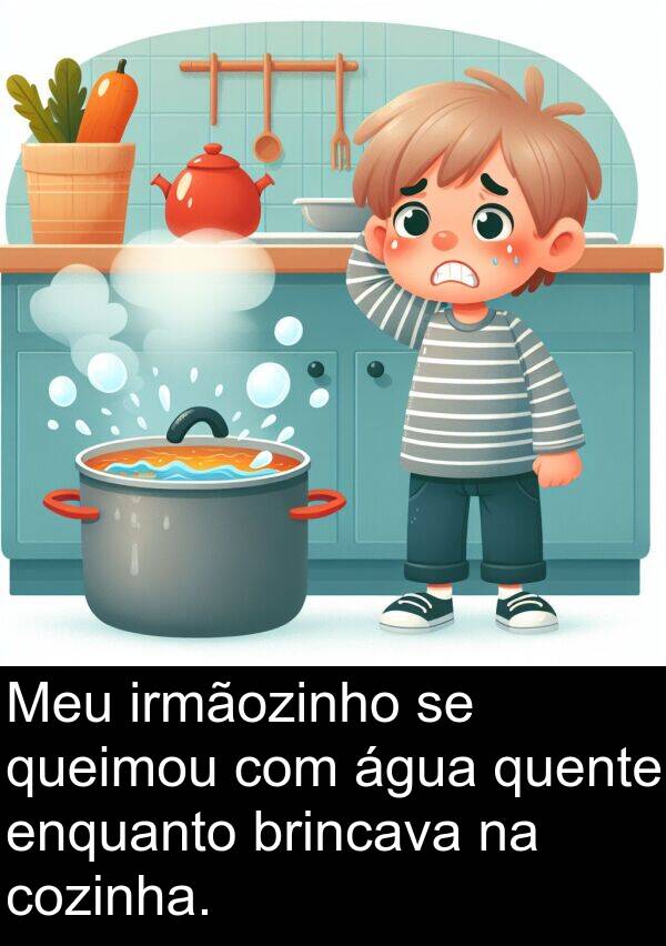 queimou: Meu irmãozinho se queimou com água quente enquanto brincava na cozinha.