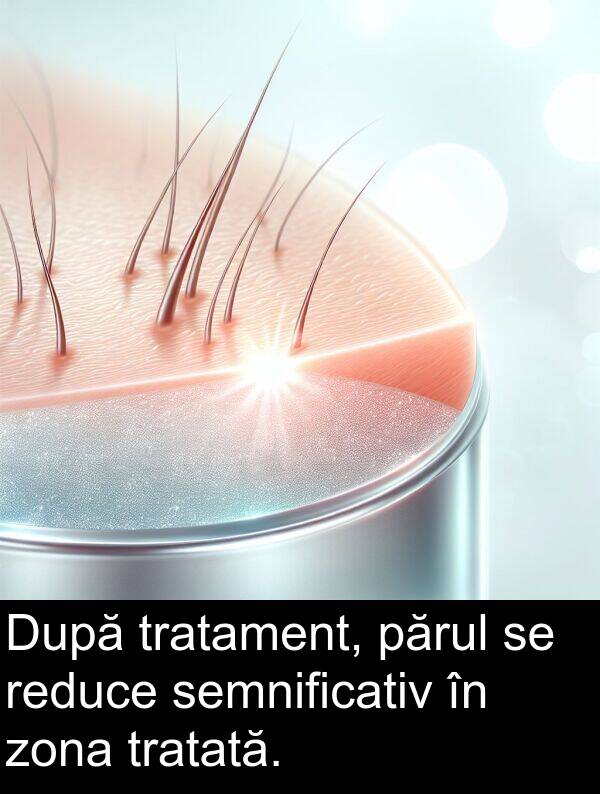 zona: După tratament, părul se reduce semnificativ în zona tratată.