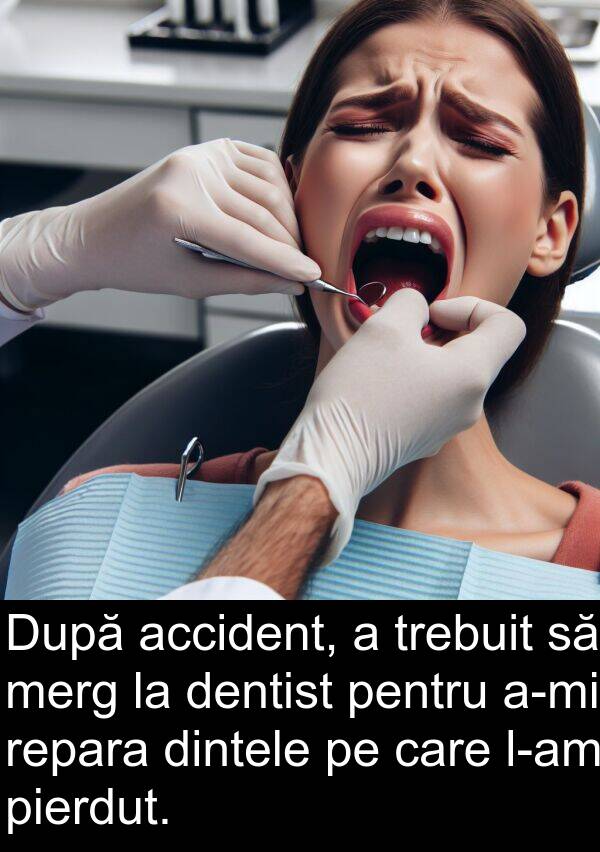 accident: După accident, a trebuit să merg la dentist pentru a-mi repara dintele pe care l-am pierdut.