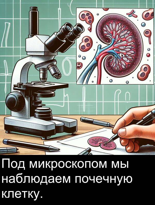 клетку: Под микроскопом мы наблюдаем почечную клетку.