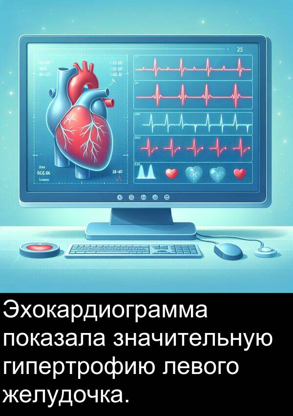 желудочка: Эхокардиограмма показала значительную гипертрофию левого желудочка.