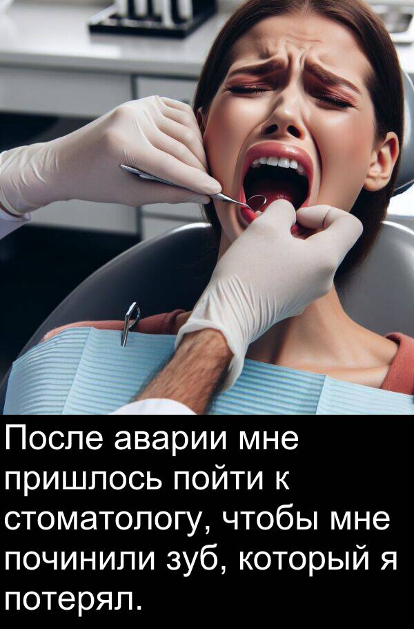 починили: После аварии мне пришлось пойти к стоматологу, чтобы мне починили зуб, который я потерял.
