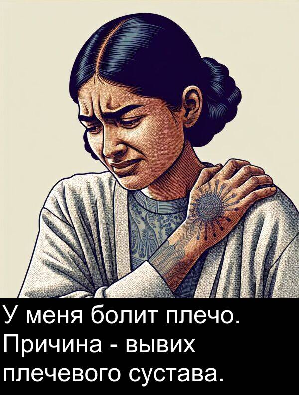 вывих: У меня болит плечо. Причина - вывих плечевого сустава.