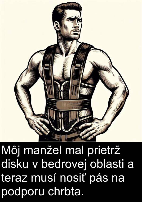 bedrovej: Môj manžel mal prietrž disku v bedrovej oblasti a teraz musí nosiť pás na podporu chrbta.
